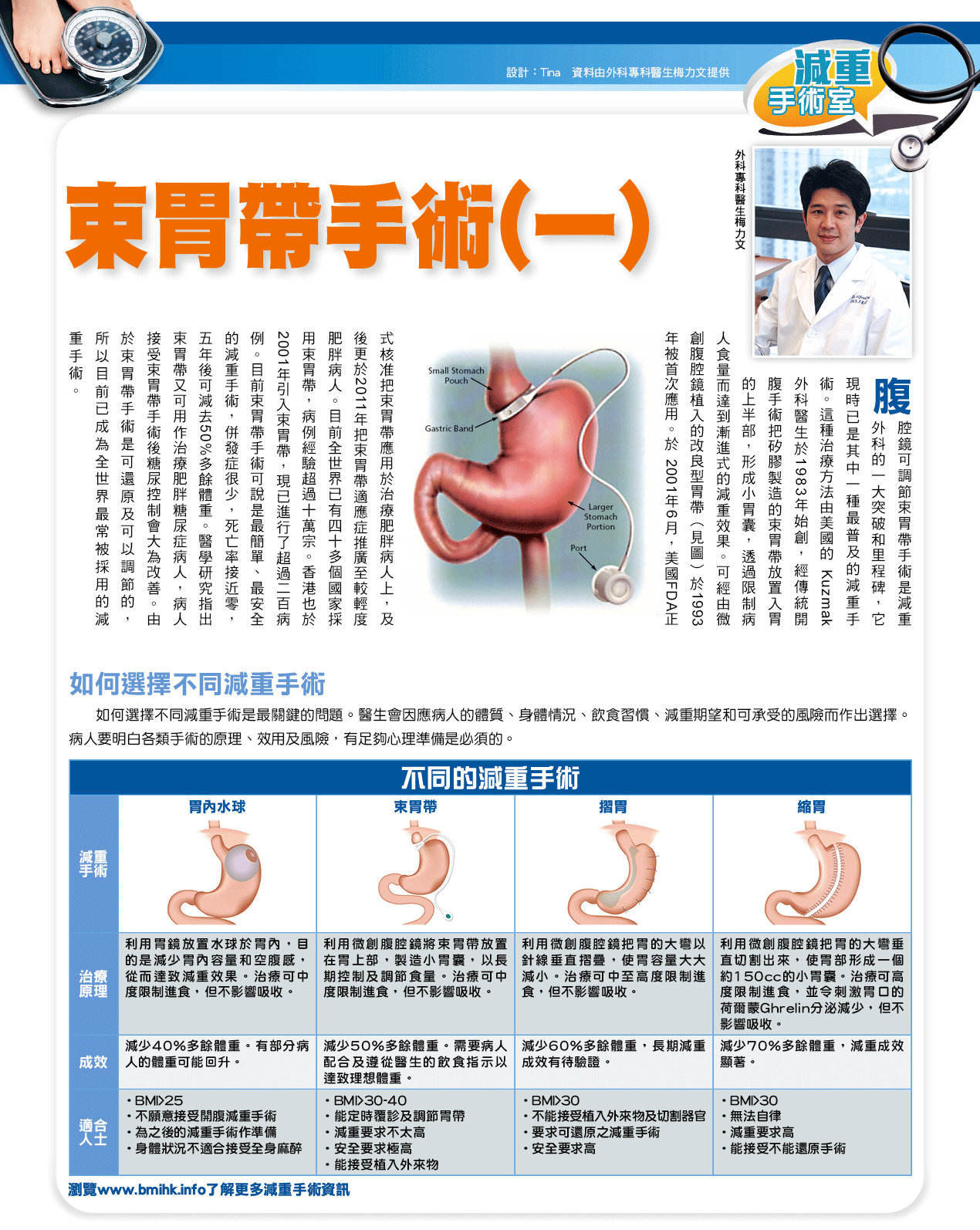 束胃帶手術（一）