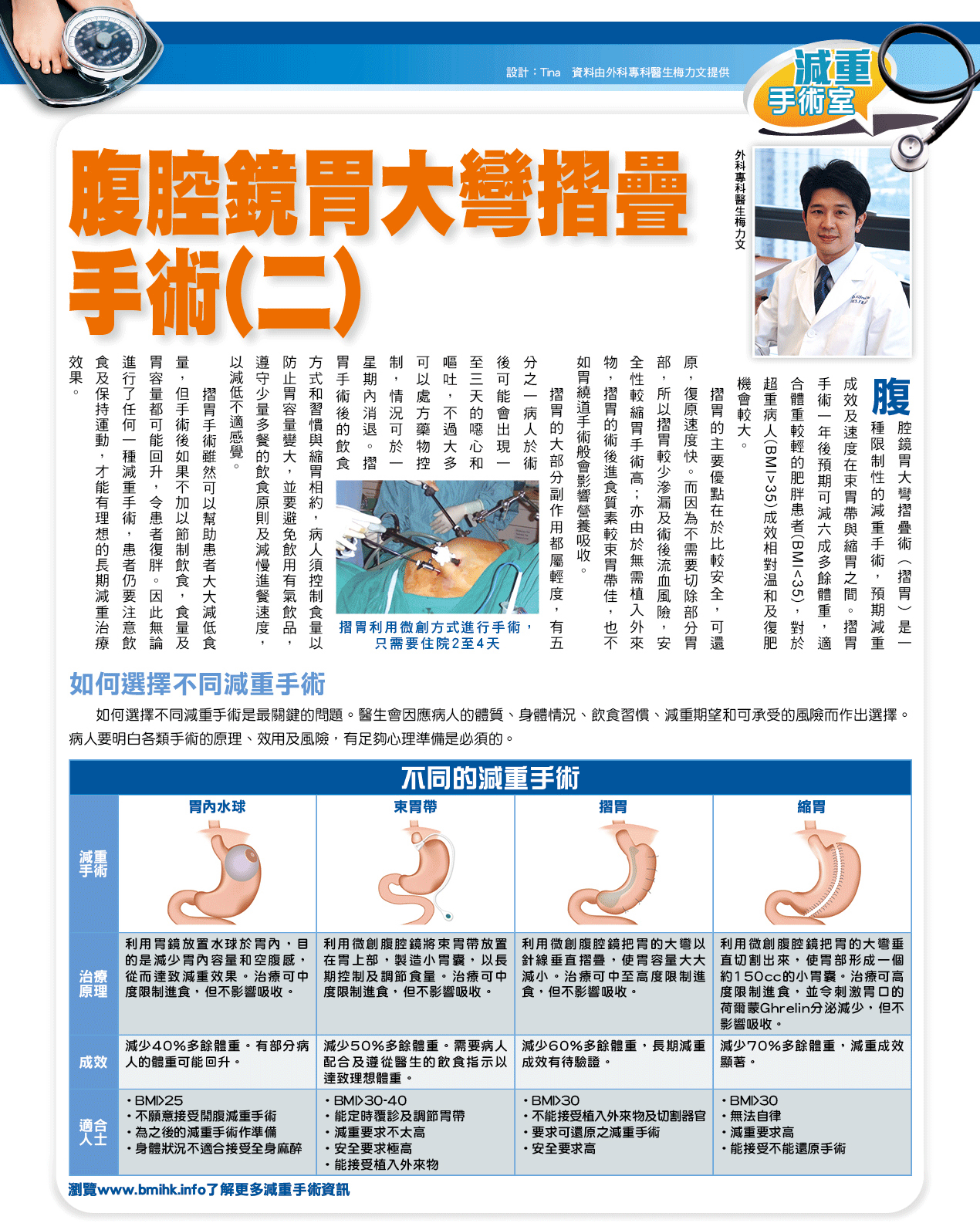 腹腔鏡胃大彎摺疊手術（二）